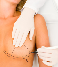 chicago breast lift implant surgery